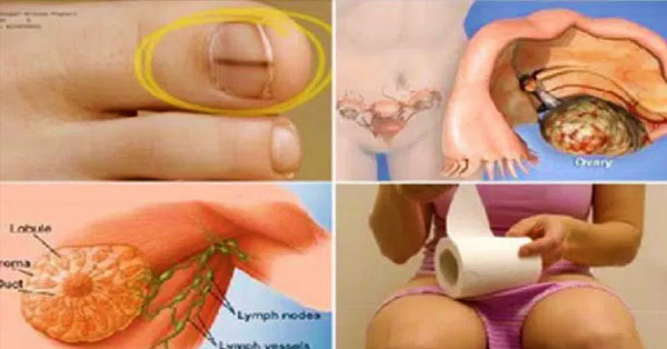 20 Deadly Cancer Signs t Women Are Most Likely To Ignore